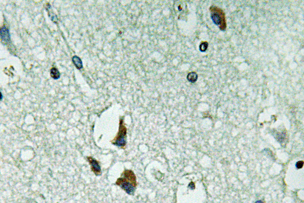 PAH Rabbit Polyclonal Antibody