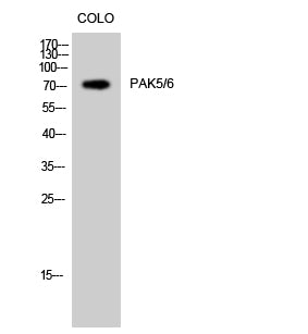 PAK5/6 Rabbit Polyclonal Antibody