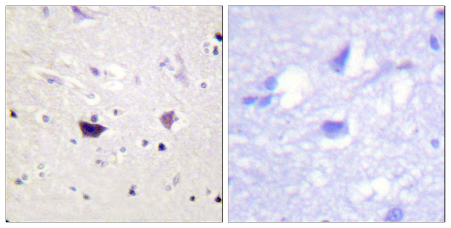 PAKα/β/γ Rabbit Polyclonal Antibody