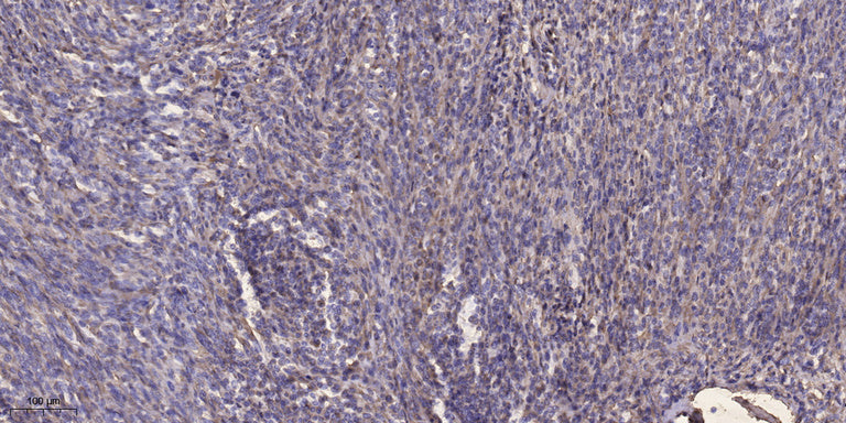 Palladin Rabbit Polyclonal Antibody