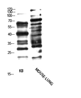 Pan myristoylation Rabbit Polyclonal Antibody