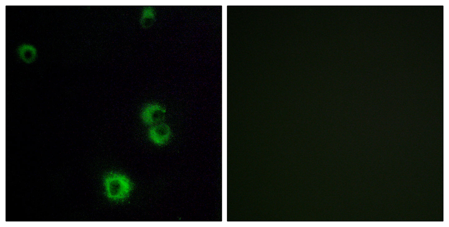 PAR-3 Rabbit Polyclonal Antibody