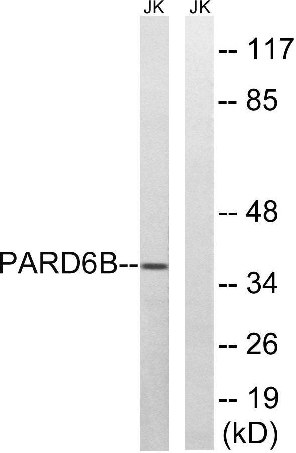 PAR-6β Rabbit Polyclonal Antibody