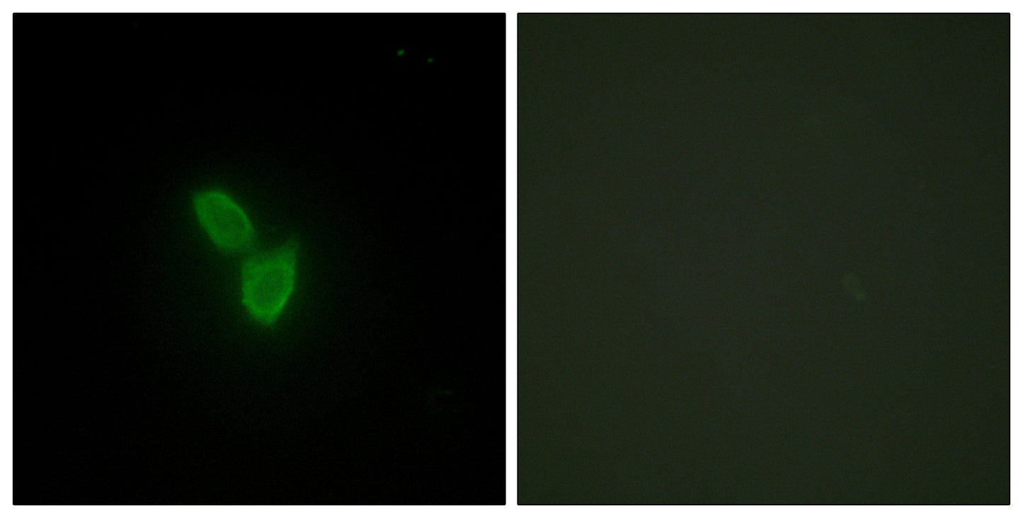 PARD3A Rabbit Polyclonal Antibody
