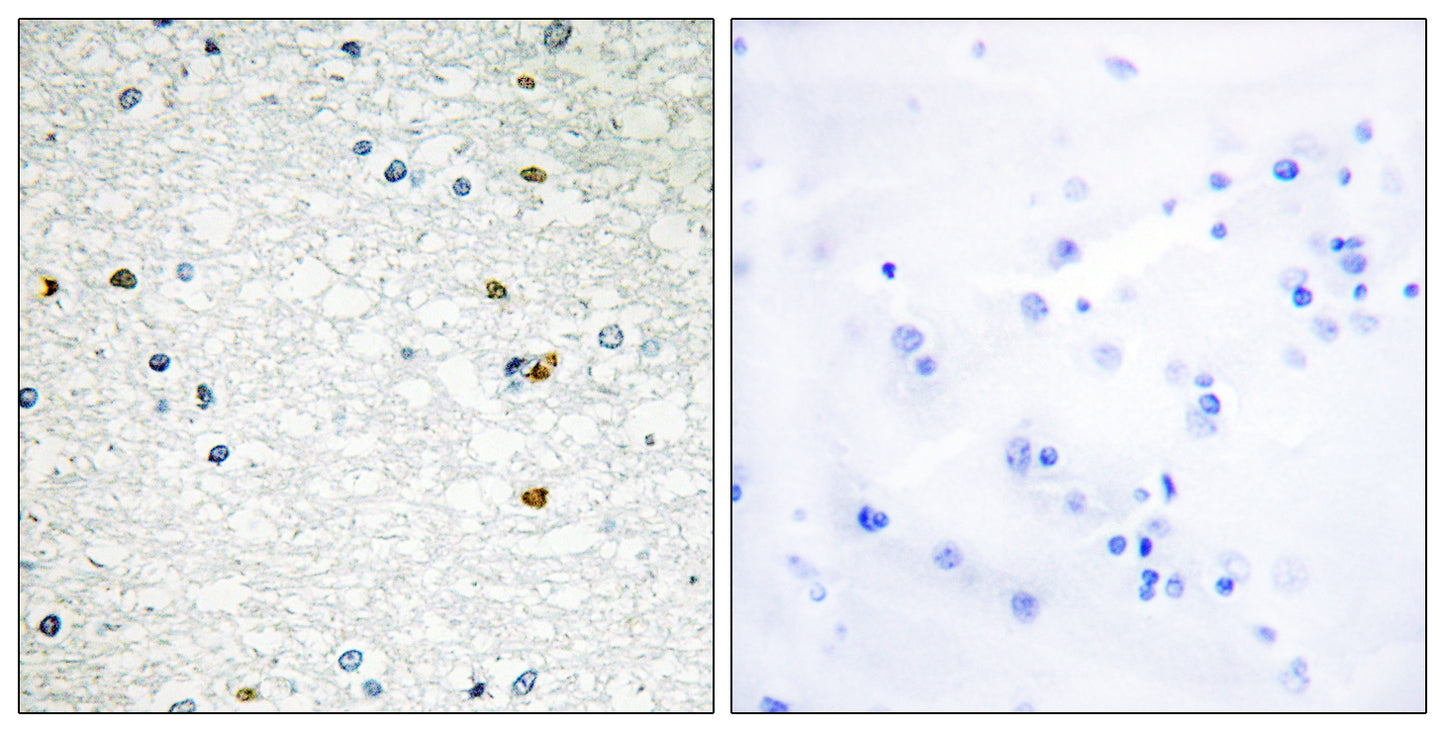 PARP-3 Rabbit Polyclonal Antibody