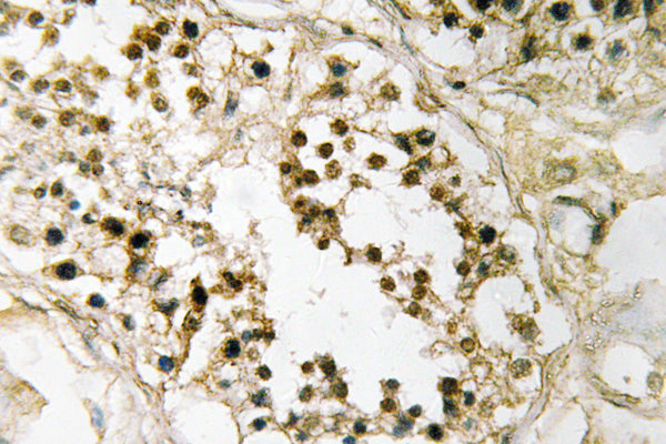 Pax-2 Rabbit Polyclonal Antibody