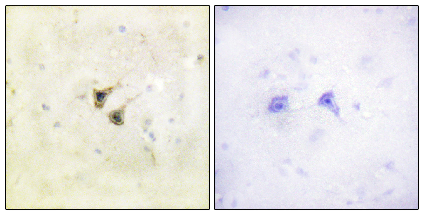PBK Rabbit Polyclonal Antibody