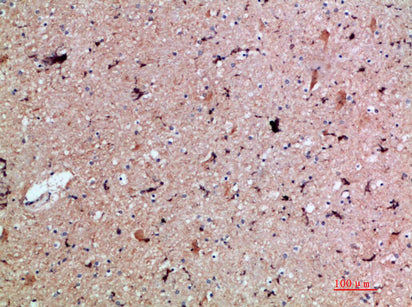 PBP Rabbit Polyclonal Antibody