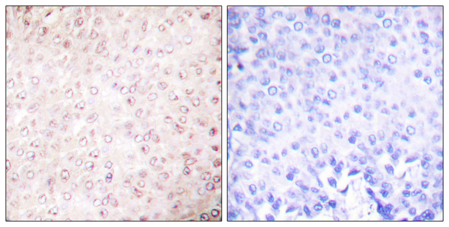 PCAF Rabbit Polyclonal Antibody