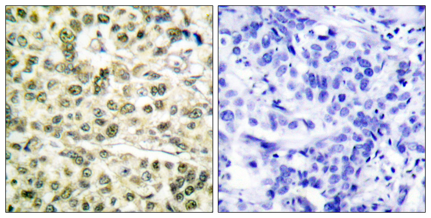 PCNA Rabbit Polyclonal Antibody