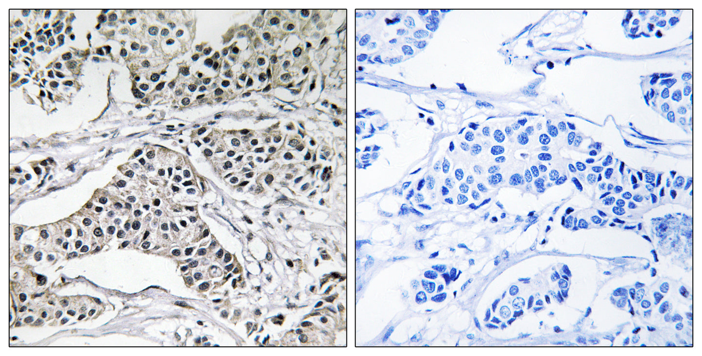 PC-PLD3 Rabbit Polyclonal Antibody