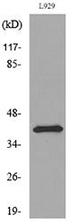PDGF-D Rabbit Polyclonal Antibody