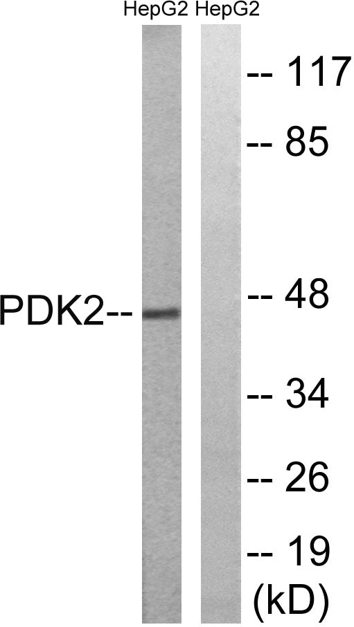 PDK2 Rabbit Polyclonal Antibody