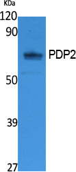 PDP2 Rabbit Polyclonal Antibody