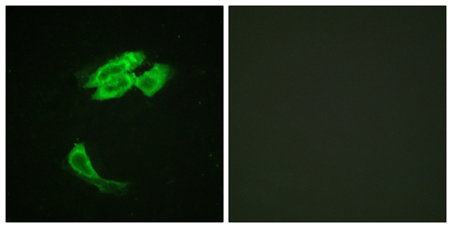 PEA-15 Rabbit Polyclonal Antibody