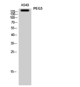 PEG3 Rabbit Polyclonal Antibody