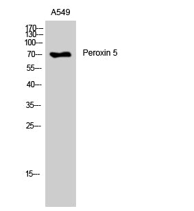 Peroxin 5 Rabbit Polyclonal Antibody