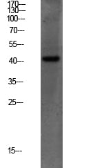 PEX14 Rabbit Polyclonal Antibody