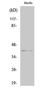 pICln Rabbit Polyclonal Antibody