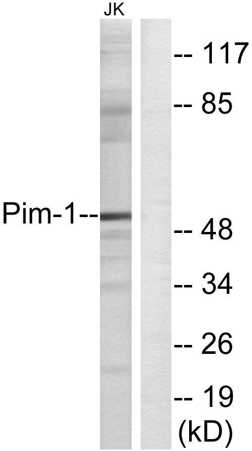 Pim-1 Rabbit Polyclonal Antibody
