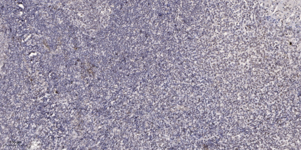 PinX1 Rabbit Polyclonal Antibody
