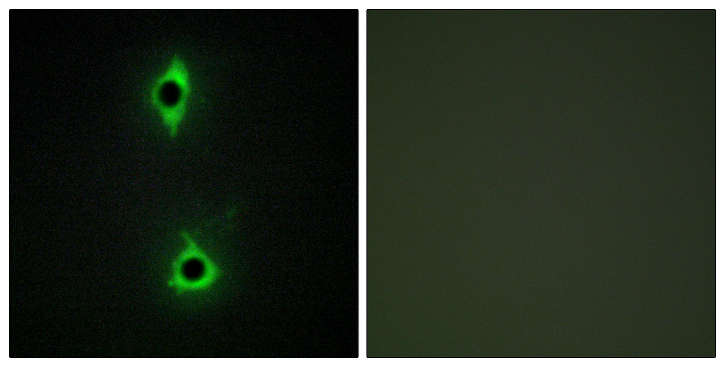 PIP5KIII Rabbit Polyclonal Antibody