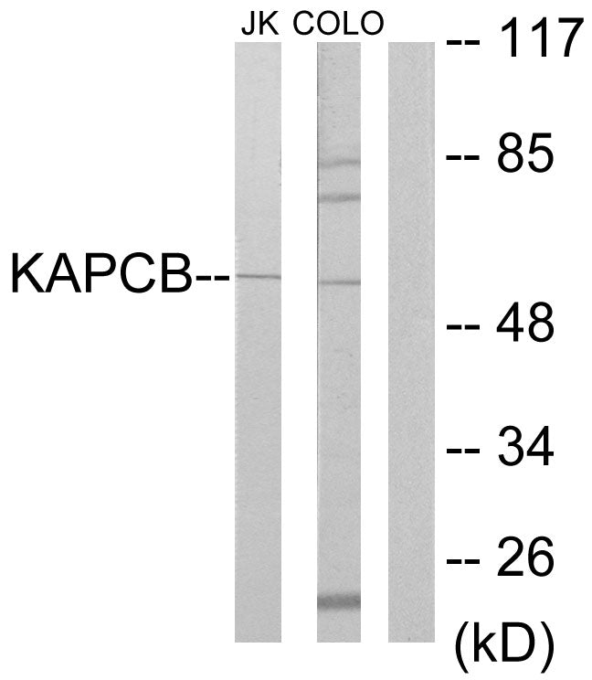 PKAβ cat Rabbit Polyclonal Antibody