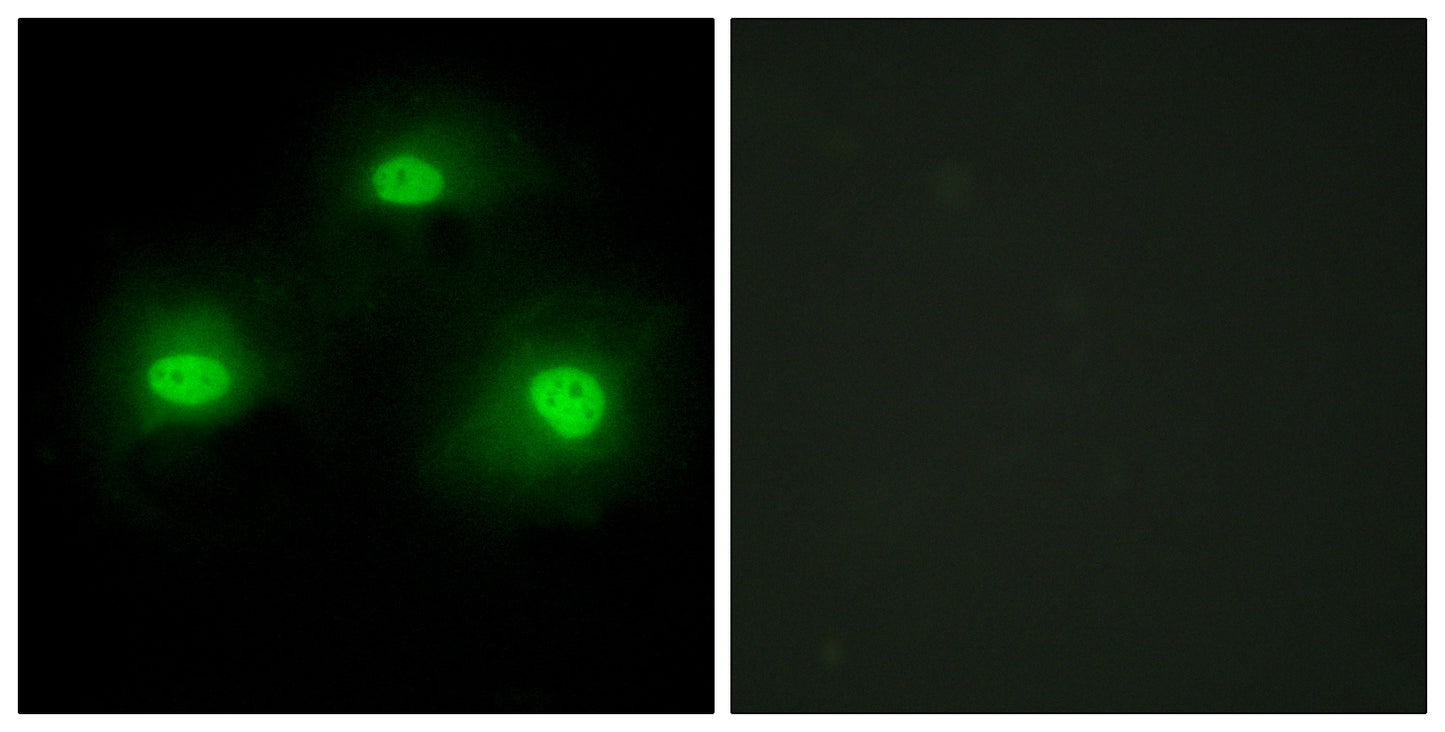 Pki α Rabbit Polyclonal Antibody