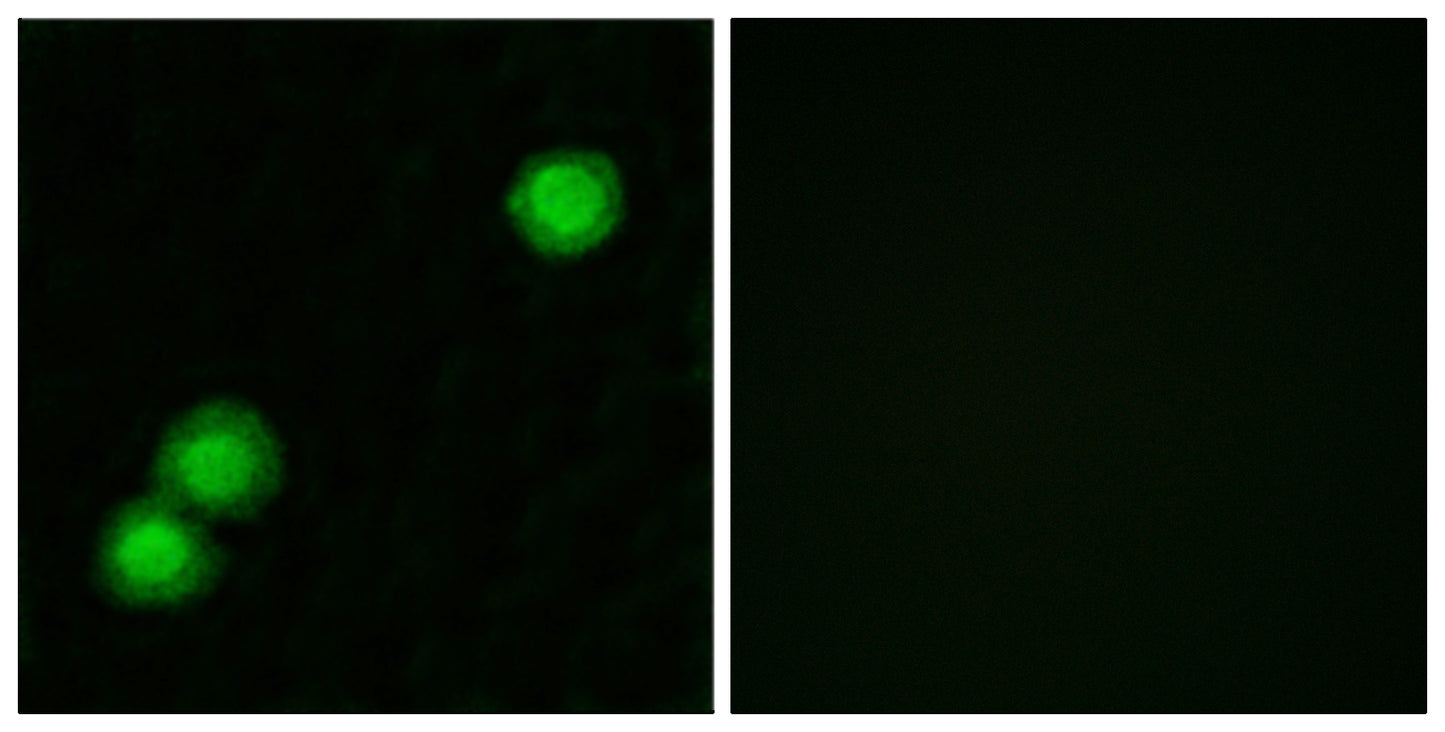 PKI β Rabbit Polyclonal Antibody