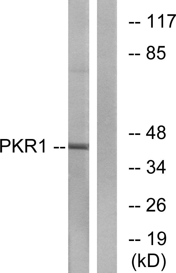 PKR1 Rabbit Polyclonal Antibody