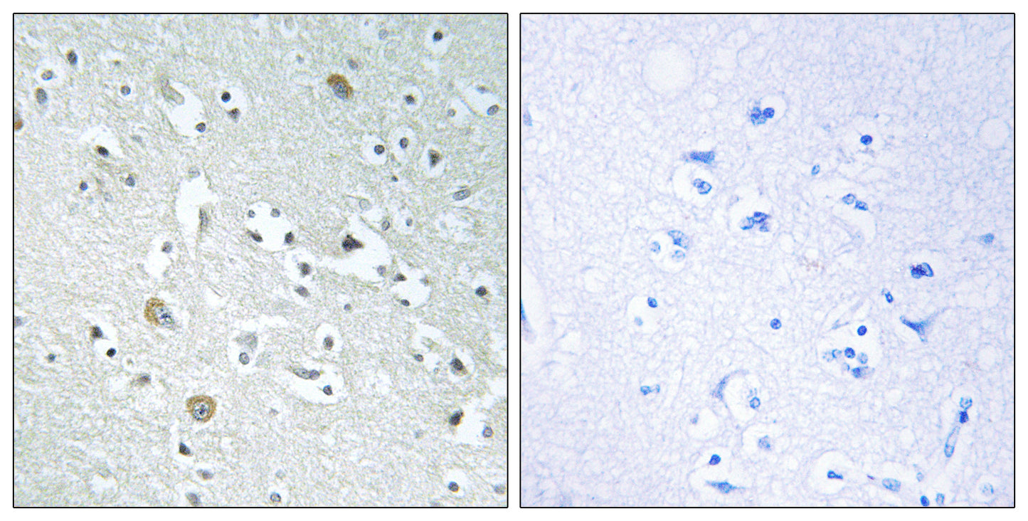 PLA1A Rabbit Polyclonal Antibody