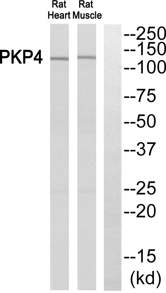 Plakophilin 4 Rabbit Polyclonal Antibody