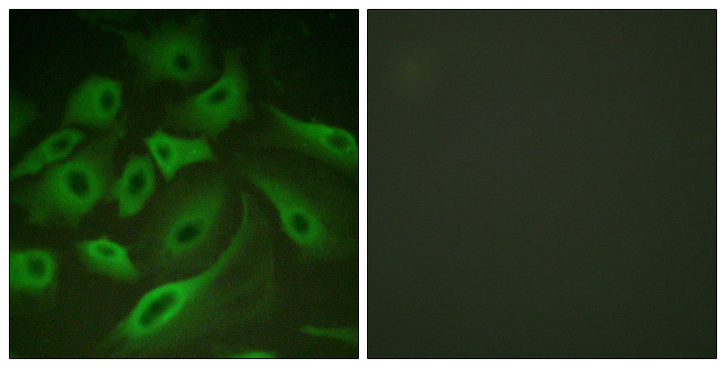 PLB Rabbit Polyclonal Antibody
