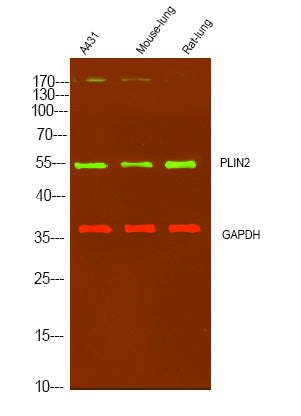 PLIN2 Rabbit Polyclonal Antibody