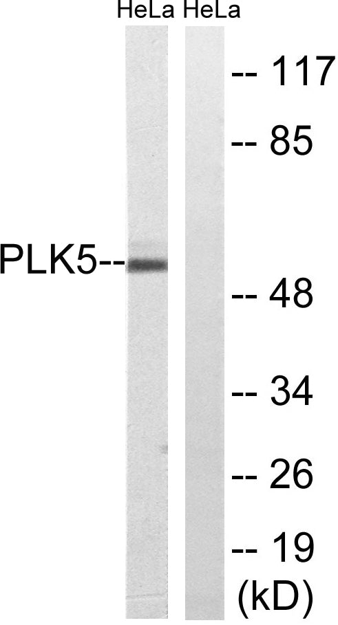 PLK-5 Rabbit Polyclonal Antibody
