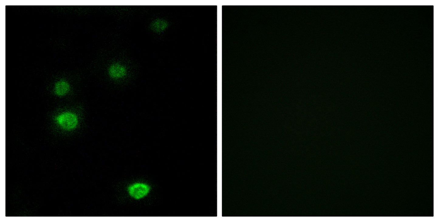 POLR3E Rabbit Polyclonal Antibody
