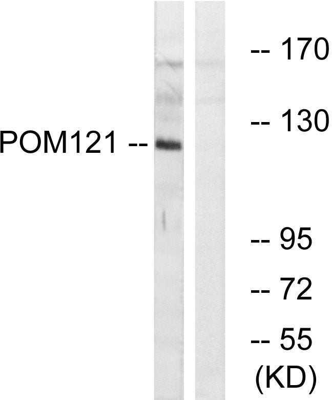 POM121 Rabbit Polyclonal Antibody