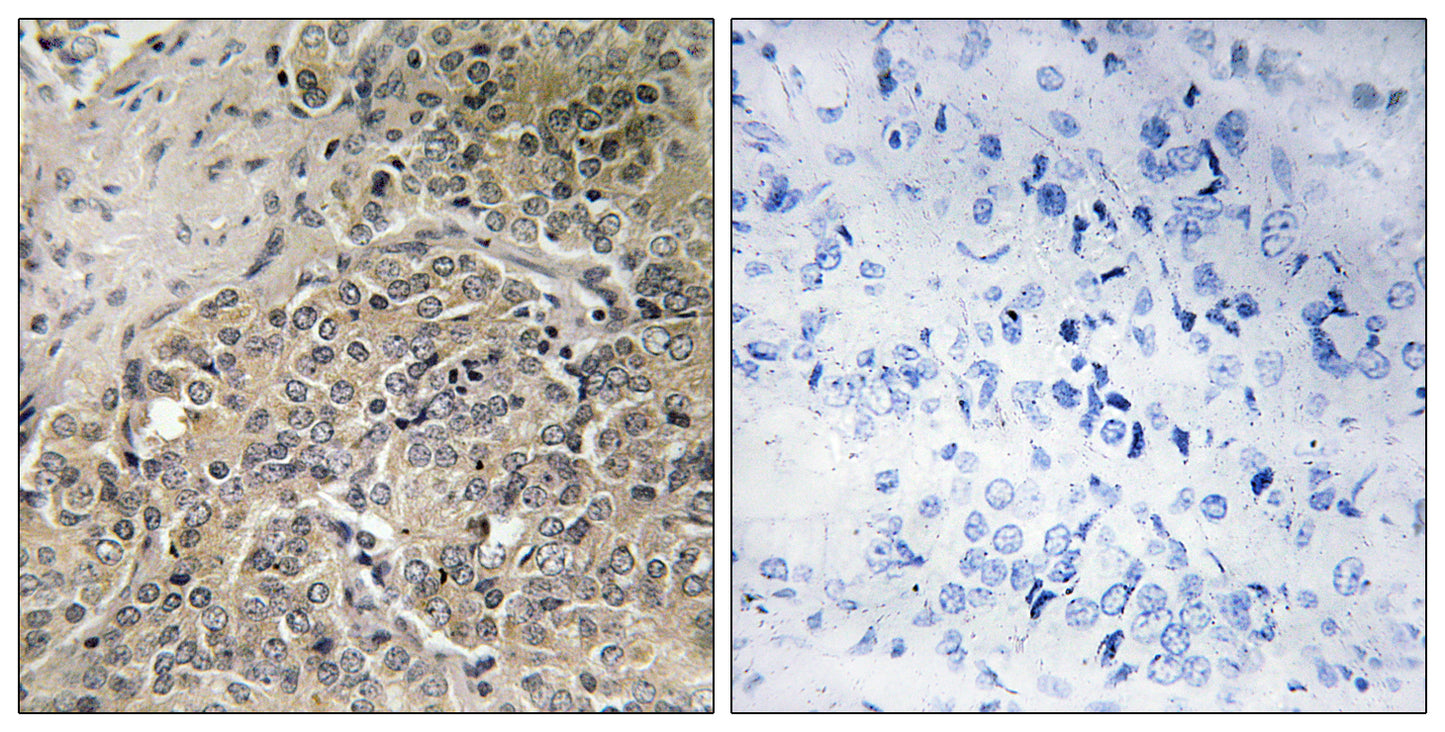 POTE14/22 Rabbit Polyclonal Antibody