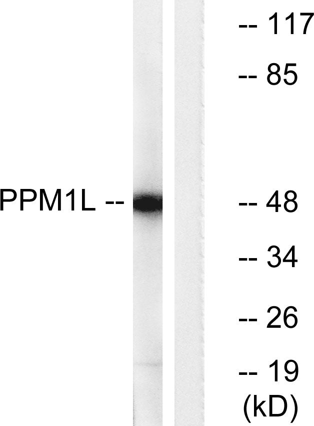 PP2Cε Rabbit Polyclonal Antibody