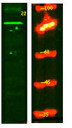 PPM1E Rabbit Polyclonal Antibody