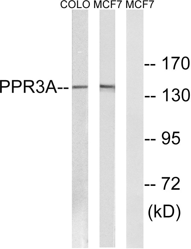 PPP1R3A Rabbit Polyclonal Antibody