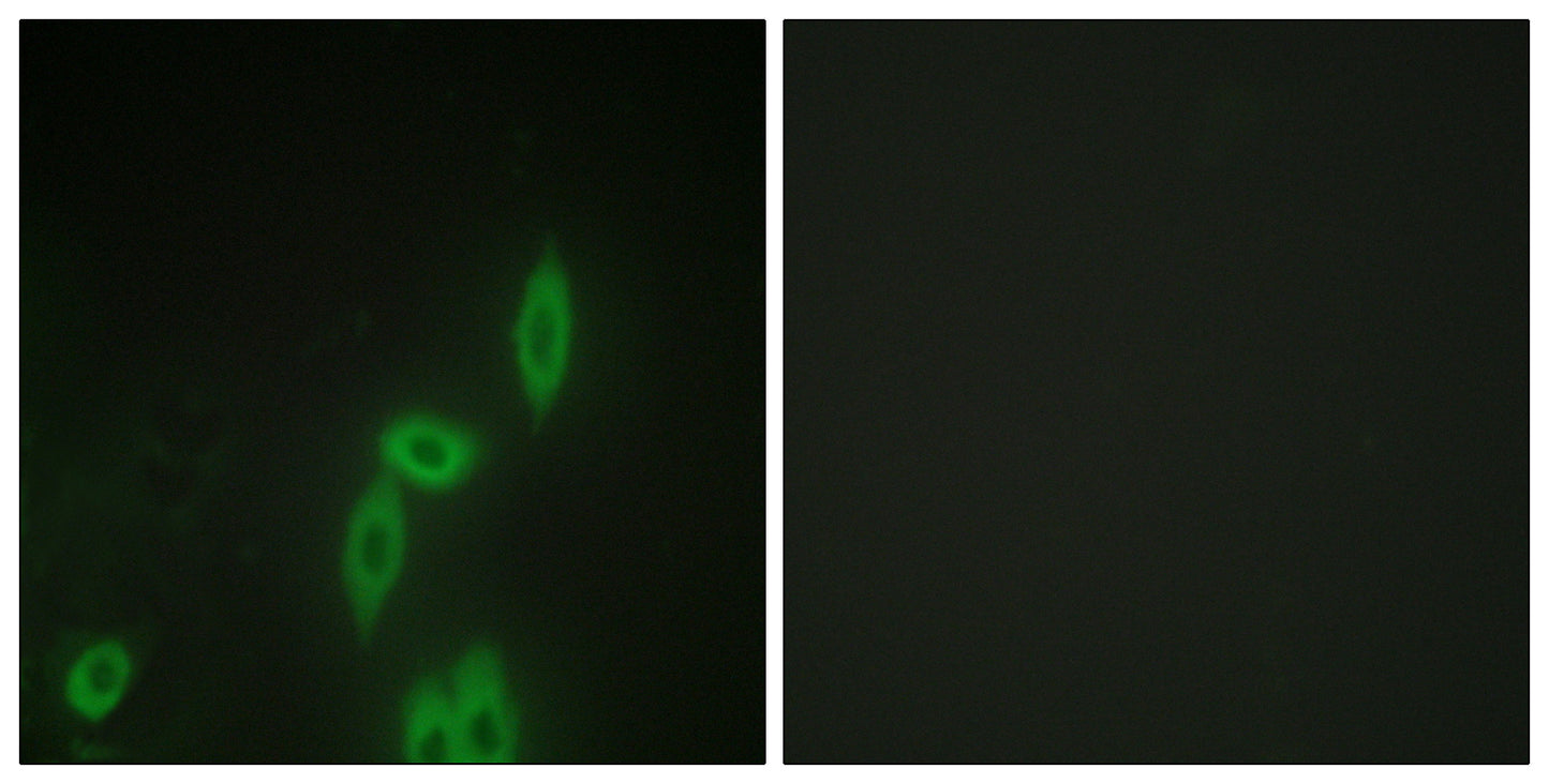 Protocadherin-11 Rabbit Polyclonal Antibody
