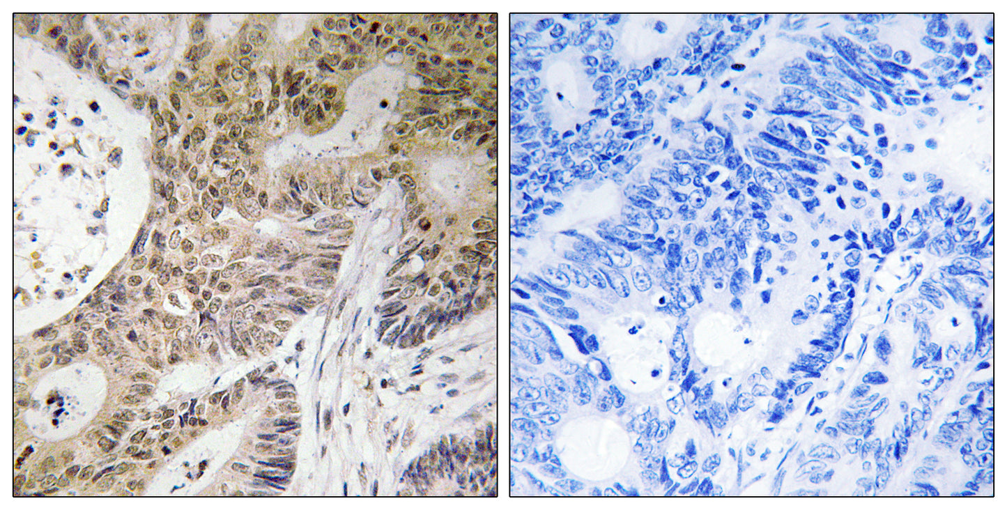 PRP6 Rabbit Polyclonal Antibody