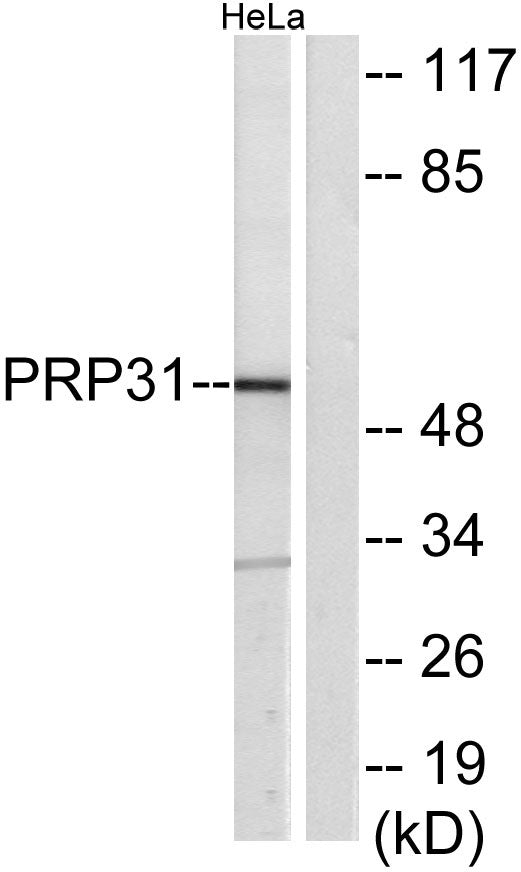 PRPF31 Rabbit Polyclonal Antibody