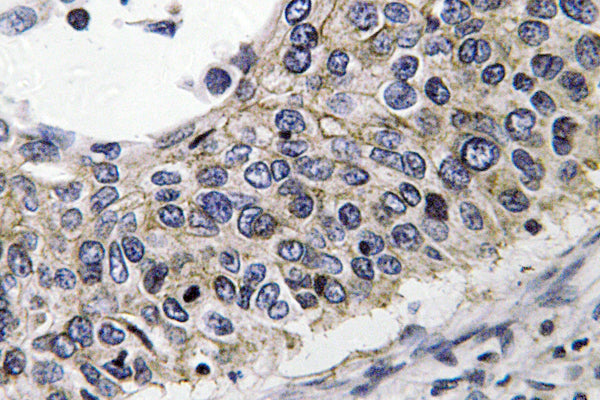 PRX III Rabbit Polyclonal Antibody