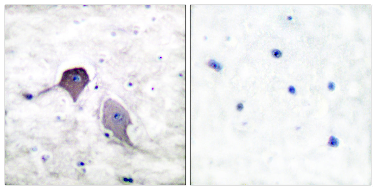 PS-1 Rabbit Polyclonal Antibody