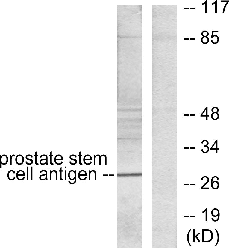 PSCA Rabbit Polyclonal Antibody