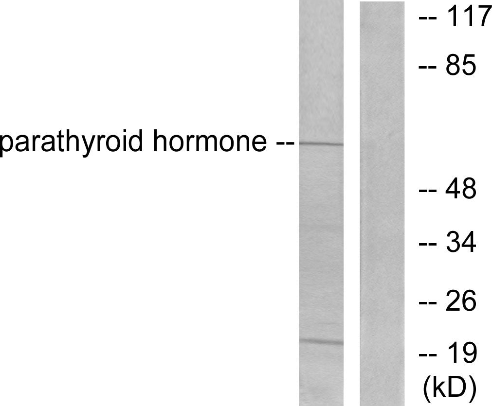 PTH Rabbit Polyclonal Antibody