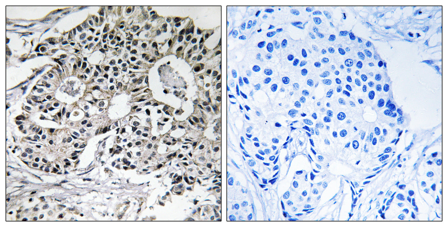Pxmp2 Rabbit Polyclonal Antibody
