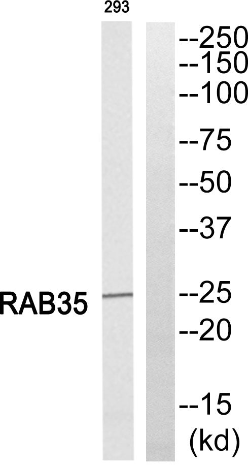 Rab 35 Rabbit Polyclonal Antibody